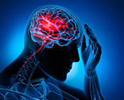 Cognitive and motor performance linked in stroke recovery