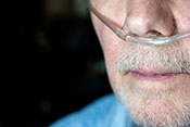 Mechanism behind COPD lung damage - Photo: ©iStock/wwing