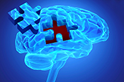 Brain study ties proteins to ‘cognitive trajectory’ in aging - Photo: ©iStock/malgorzata tatarynowicz