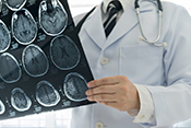 MRI could help detect early Alzheimer’s - Photo: ©iStock/utah778