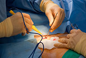 Rates of hospital admission after VA outpatient surgery - Photo:©iStock/Rpsycho