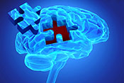Oxytocin fails to boost social cognition in schizophrenia trial - Illustration: ©iStock/goa_novi