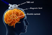 Brain structures account for transcranial magnetic stimulation effectiveness