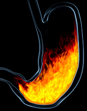 Heartburn drugs linked to kidney disease
