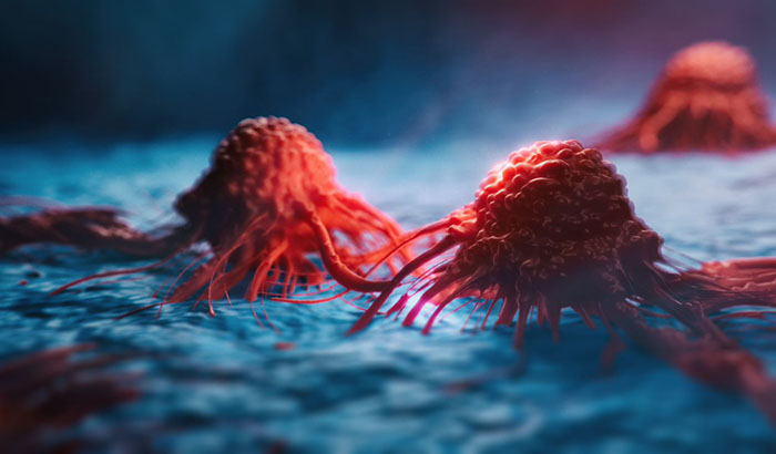 Neoantigens help direct the body's natural immune response by tagging cancer cells. They can also help vaccines detect and destroy cancer. (Photo for illustrative purposes only: @Getty Images/koto-feja)