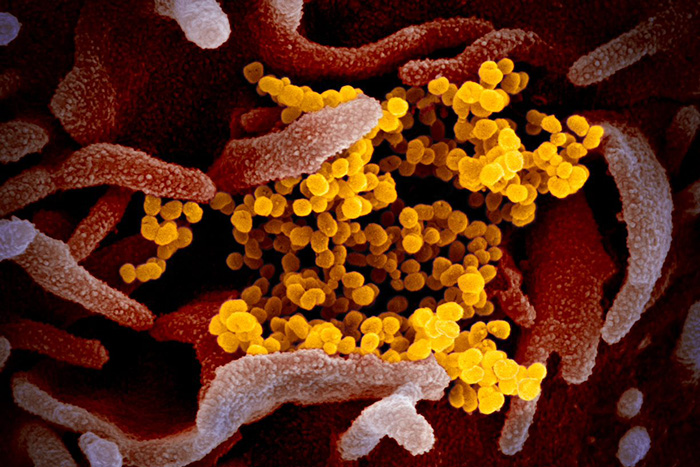 Scanning electron microscope image of SARS-CoV-2 viruses (yellow), the virus that causes COVID-19, emerging from the surface of a cell. Photo courtesy of NIAID.