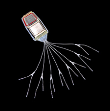 An example of an implantable pulse generator, with electrodes attached via wires. The generator is about 4 inches long. 