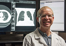 Study finds shortcomings in how doctors talk about lung nodules