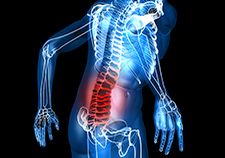 X-rays or other imaging tests for lower back pain are one example of medical testing that is common yet unnecessary in many cases, according to VA's Dr. Eve Kerr and other experts with the Choosing Wisely initiative.